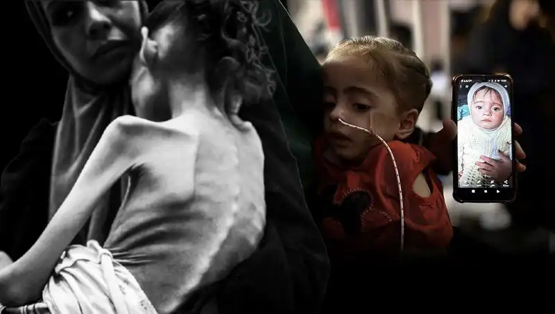 Küçük Meryem'in Mücadelesi: 25 Kilodan 10 Kiloya Düşen Bir Çocuğun Hikayesi