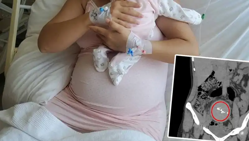 Doğumda Gazlı Bez Unutuldu, İki Yıl Sonra Skandal Ortaya Çıktı!