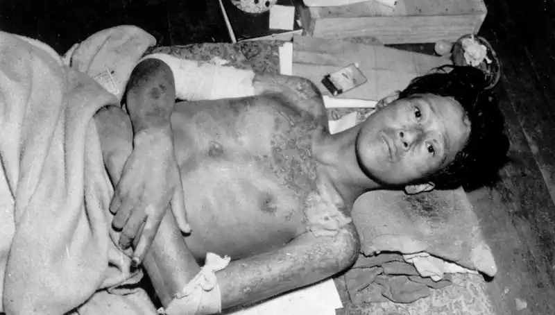 Nagasaki'den Gelen Uyarı: Nükleer Felaket Tehdidi Ve Sonuçları